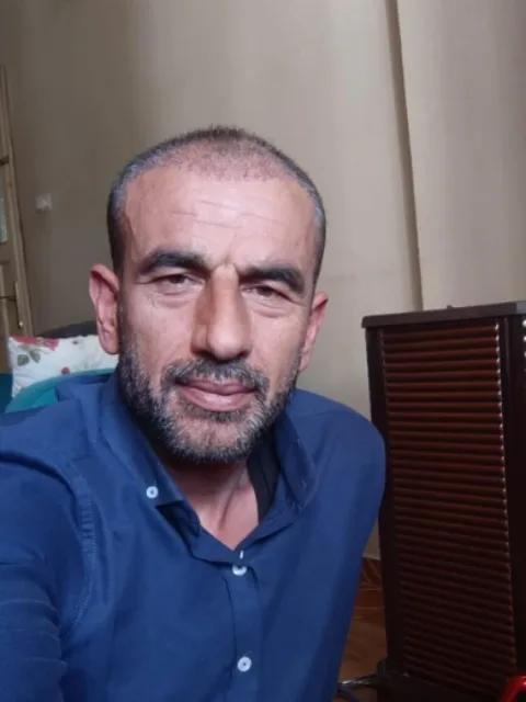 Saç ekimi öncesi, vaka 3